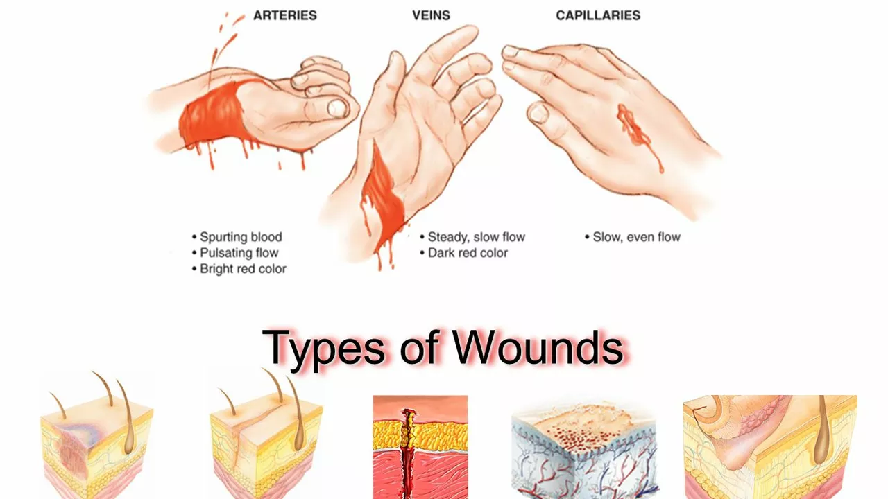 Understanding the different types of soft tissue injuries